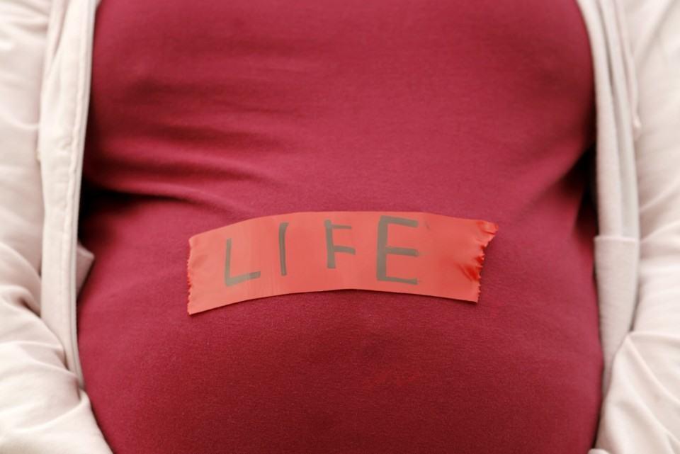 Abortion (áááŻááşáááşááťááşááťááźááşá¸)