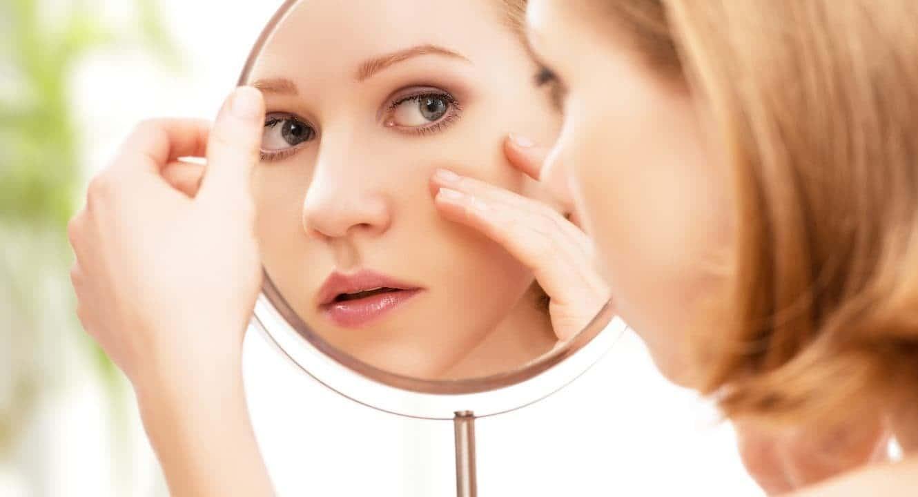 Acne (ဝက်ခြံ)