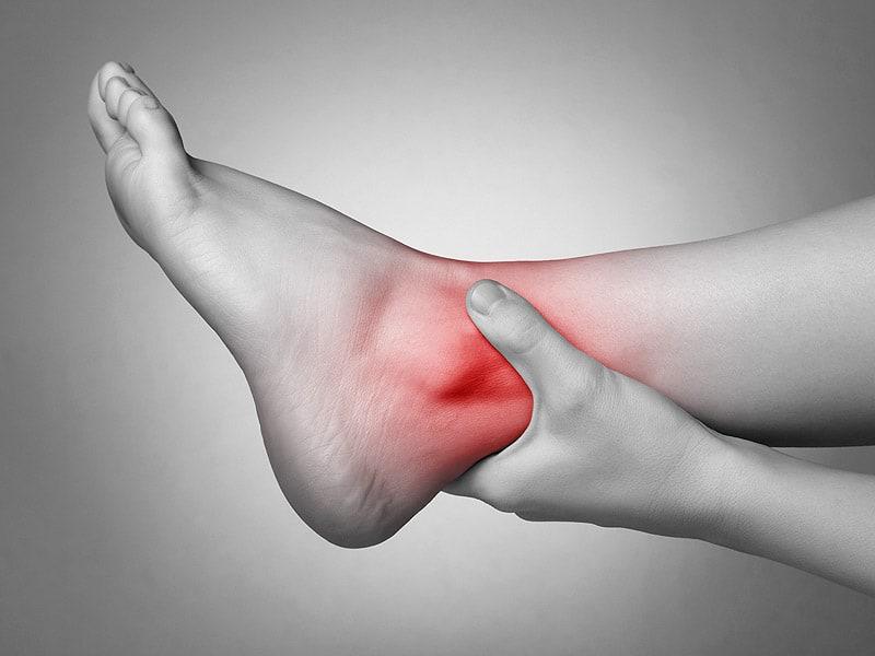 Ankle Sprain (ááźáąááťááşá¸áááşáááşááźááşá¸/ ááąáŤááşááźááşá¸)