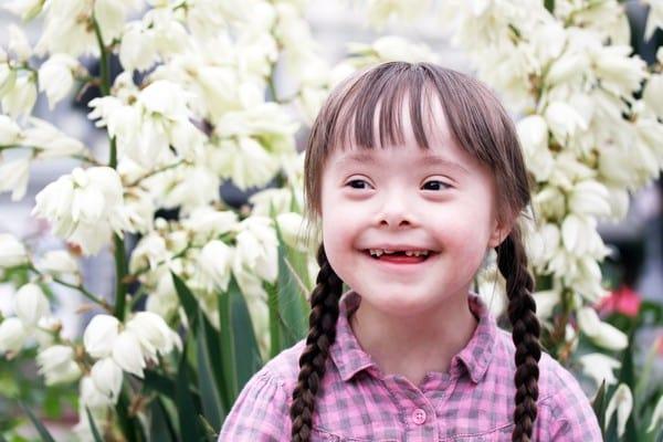 Down Syndrome (ဒေါင်းဆင်ဒရုန်း)