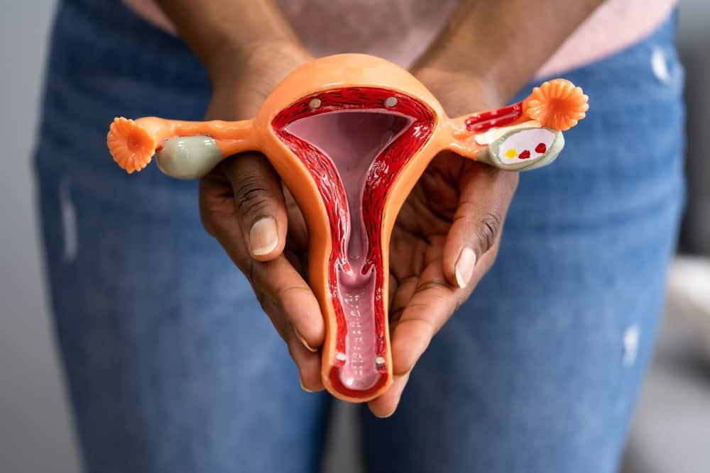 Uterine Cancer (သားအိမ်ကင်ဆာ)