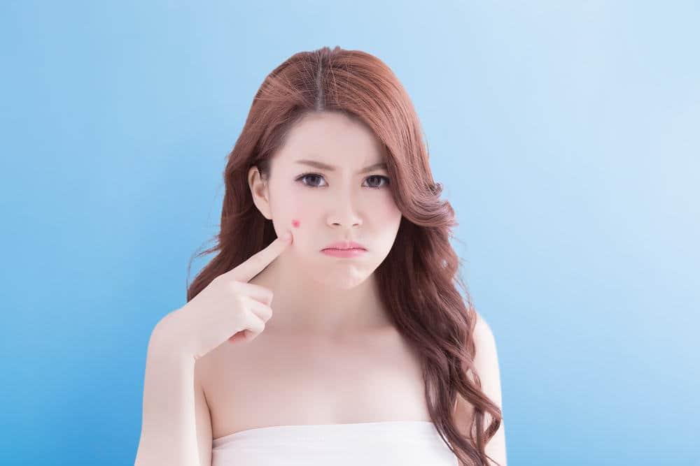 cystic acne(ဆစ်စတစ်ဝက်ခြံ) ဆိုတာဘာလဲ, ဘယ်လိုကုမလဲ