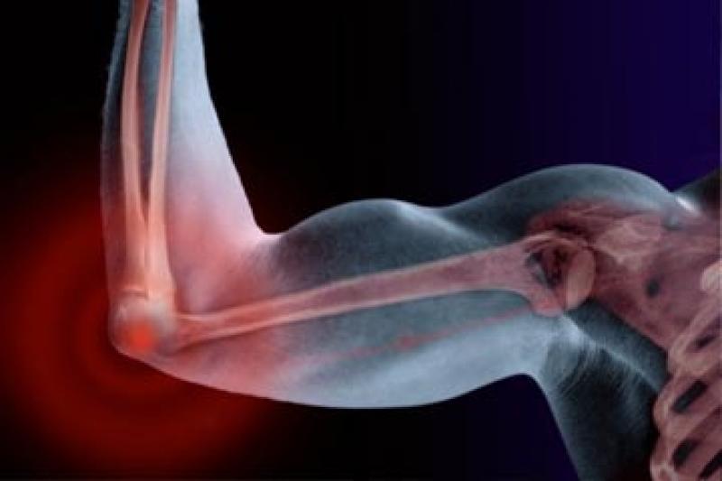 Nursemaid's Elbow (တံတောင်ဆစ် အရိုးလွဲခြင်း)