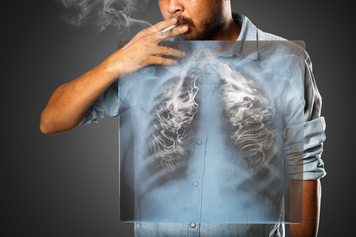 Lung Disease (အဆုတ်ရောဂါ)
