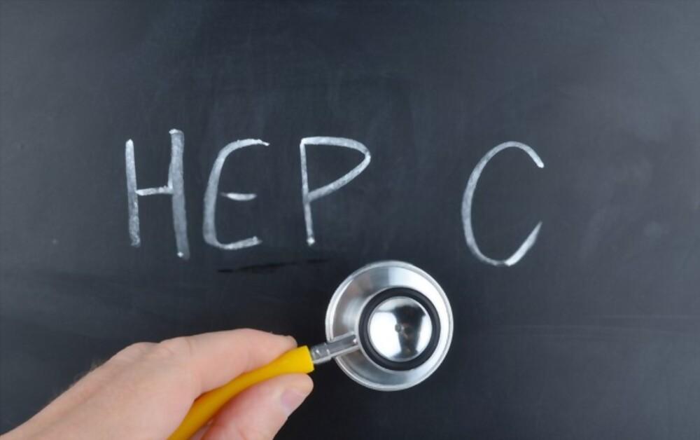 Hepatitis C (စီပိုးကြောင့်အသည်းရောင်ခြင်း )