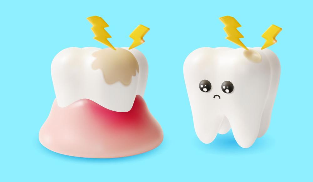Dental abscess ( သွားနှင့် သွားဖုံးပြည်တည်ခြင်း )