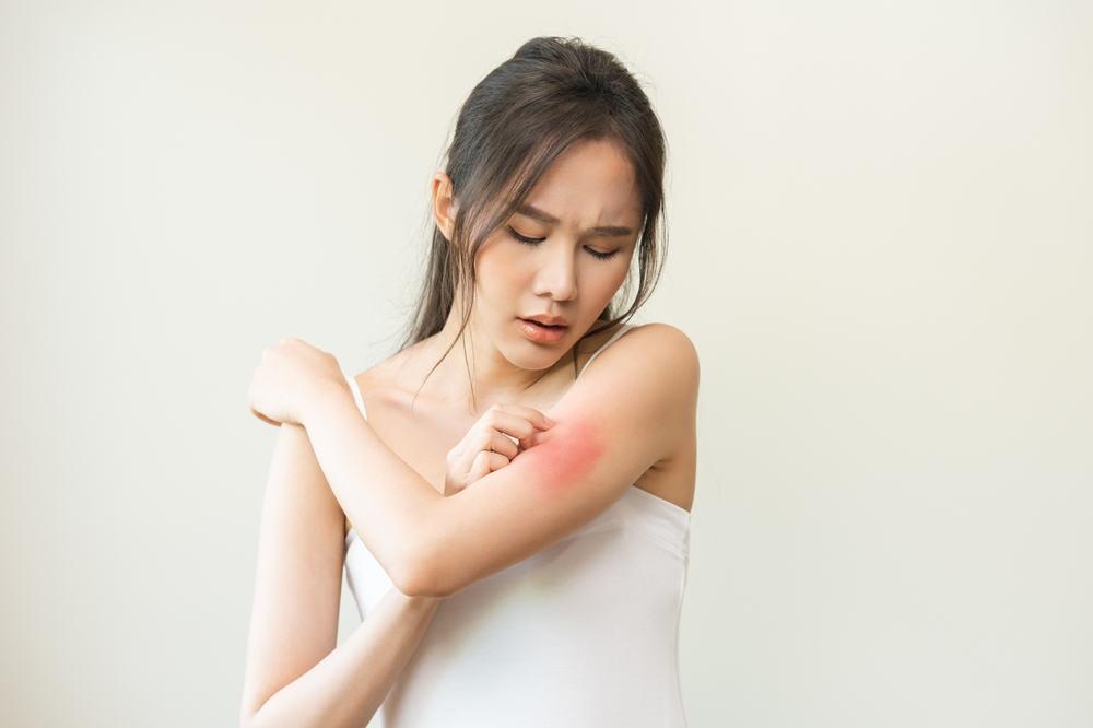 Pruritus (အရေပြားယားယံခြင်း)
