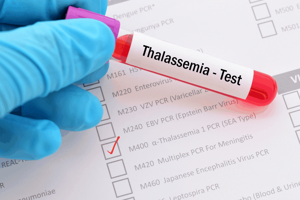 Thalassemia ရောဂါ နှင့် အာဟာရ