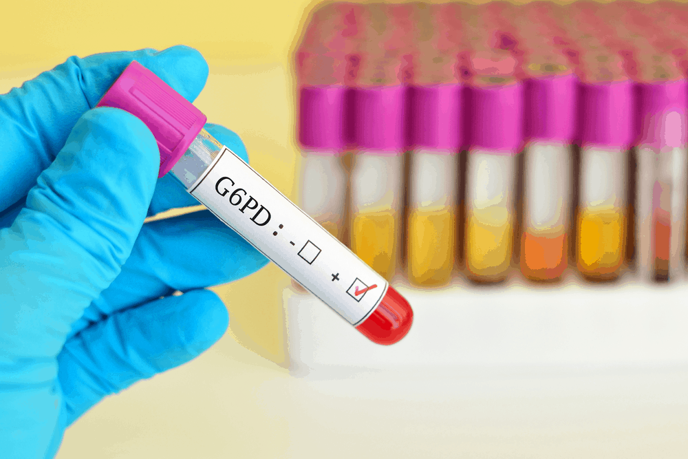 G6PD ááąáŹááŤáážááá˛áˇ áááąá¸áá
áşááąáŹááşááᯠáááşáááŻááźáŻá
áŻááᲠá á