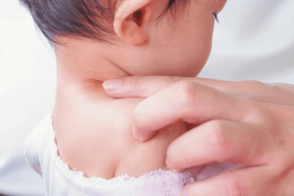 ( Sternocleidomastoid Tumor) áá˝áąá¸áááşá¸á
áááąá¸áááşáá˝áąáááşáááşá¸áážáŹ áĄááťáááşáááşááźááşá¸ á