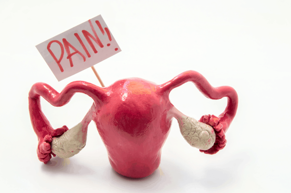 Endometriosis သားအိမ်အတွင်းဆဲလ်များနေရာလွဲခြင်း။
