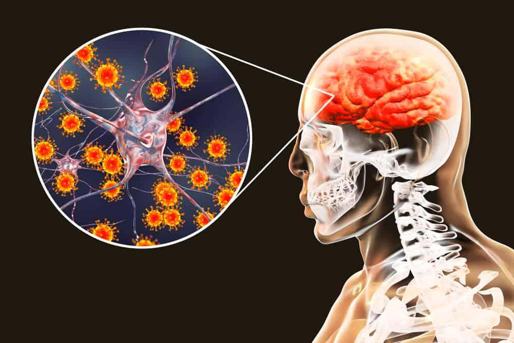 ဦးနှောက်ရောင် ခြင်း (Encephalitis) အကြောင်း