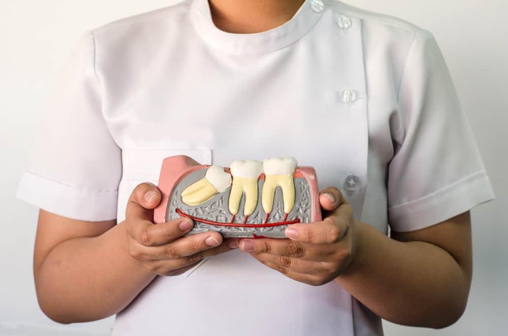 တတိယအံသွား ဒါမှမဟုတ် Wisdom Teeth နဲ့ပတ်သက်လို့သိကောင်းစရာ