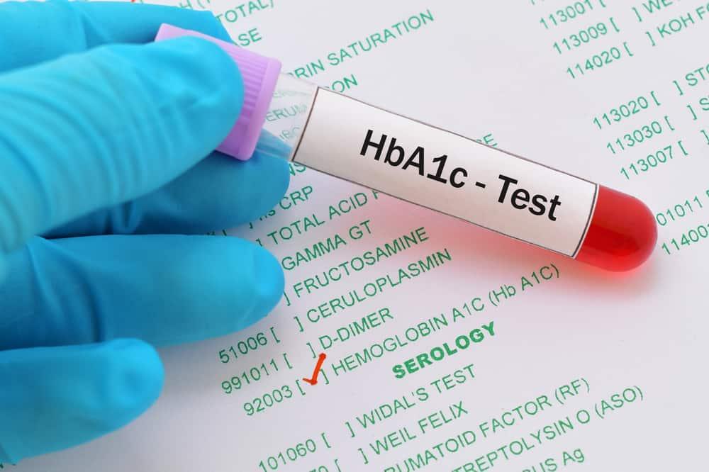 ဆီးချိုရောဂါနှင့် HbA1c
