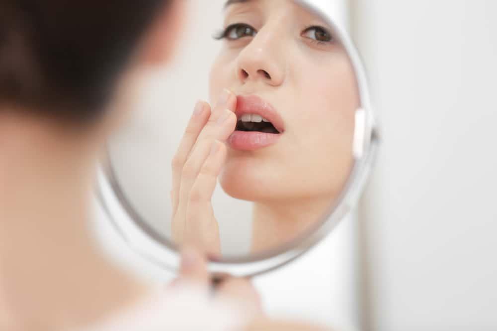 နှုတ်ခမ်းတွင် ပေါက်သော ရေယုန်နာ (Cold Sore)