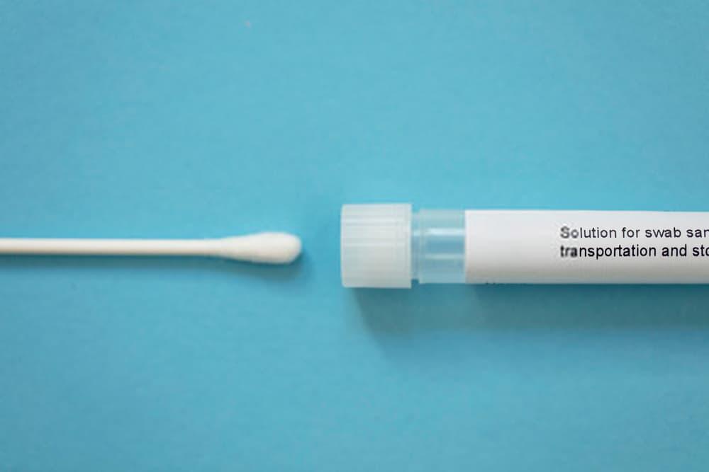 ကိုဗစ် antigen test kit တွေ ဘယ်သူတွေပဲ စစ်လို့ရလဲ။