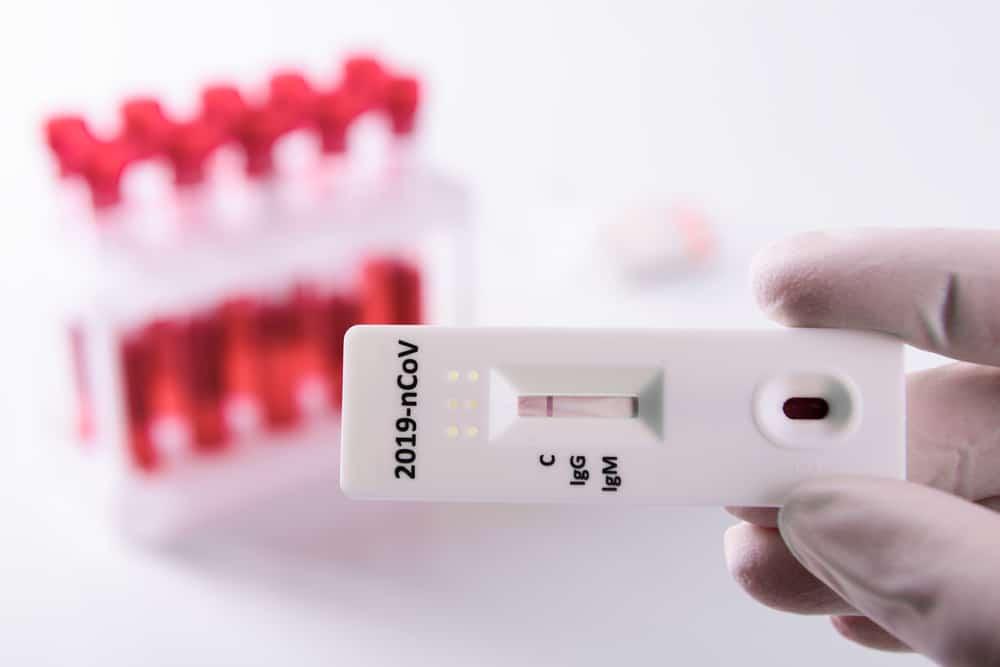 ကိုဗစ် Antibody စစ်ပြီး အဖြေဖတ်နည်း