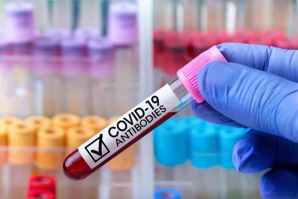 ကိုဗစ်ဖြစ်ပြီး ထွက်တဲ့ antibodies ဘယ်လောက်ခံလဲ.......