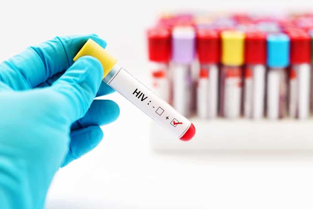 HIV စစ်ဆေးနည်း ဘယ်နှမျိုး ရှိသလဲ။