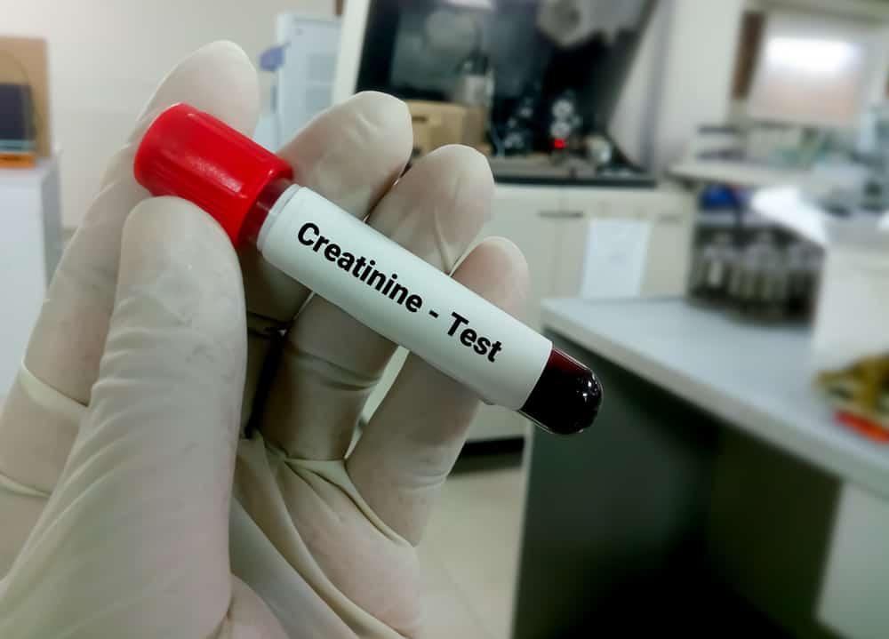 သွေးထဲမှာ Creatinine မြင့်တက်နေရတဲ့ အကြောင်းအရင်းက ဘာများလဲ!