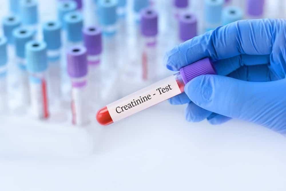 Creatinine Levels ဘာကြောင့် ကျဆင်းနေပါသလဲ!